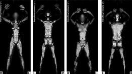 Image from an active millimeter wave body scanner. Credit: public domain via Wikipedia